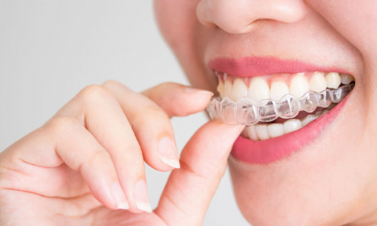 Quality, Affordable Invisalign in Newmarket