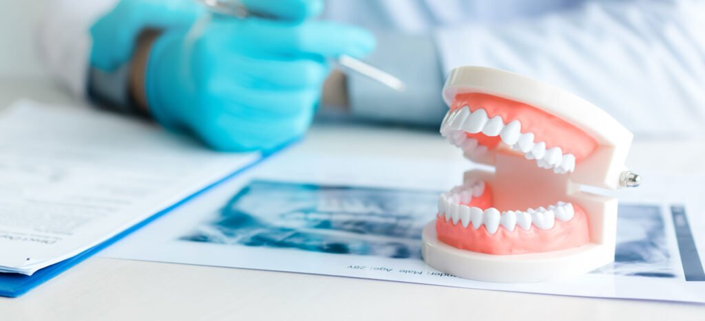 Denture Relines