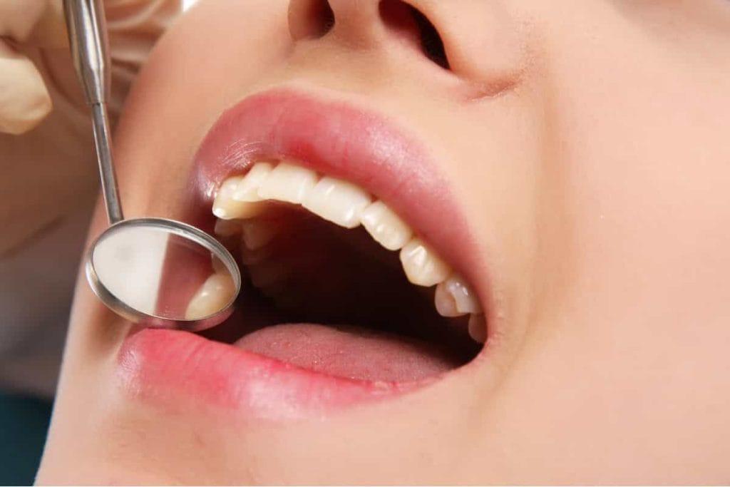 Oral-Cancer-Screening | Regular Oral Checkups