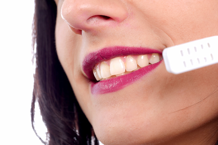 Why Choose Dental Veneers?