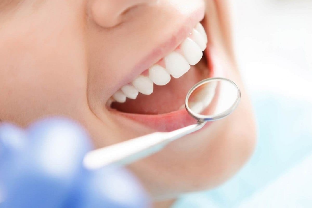 Dental Crowns & Bridges