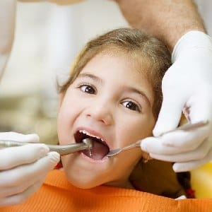 Fillings dental children