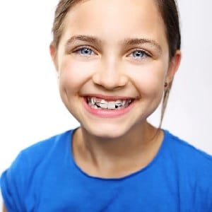 Orthodontic children