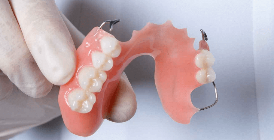 partial denture