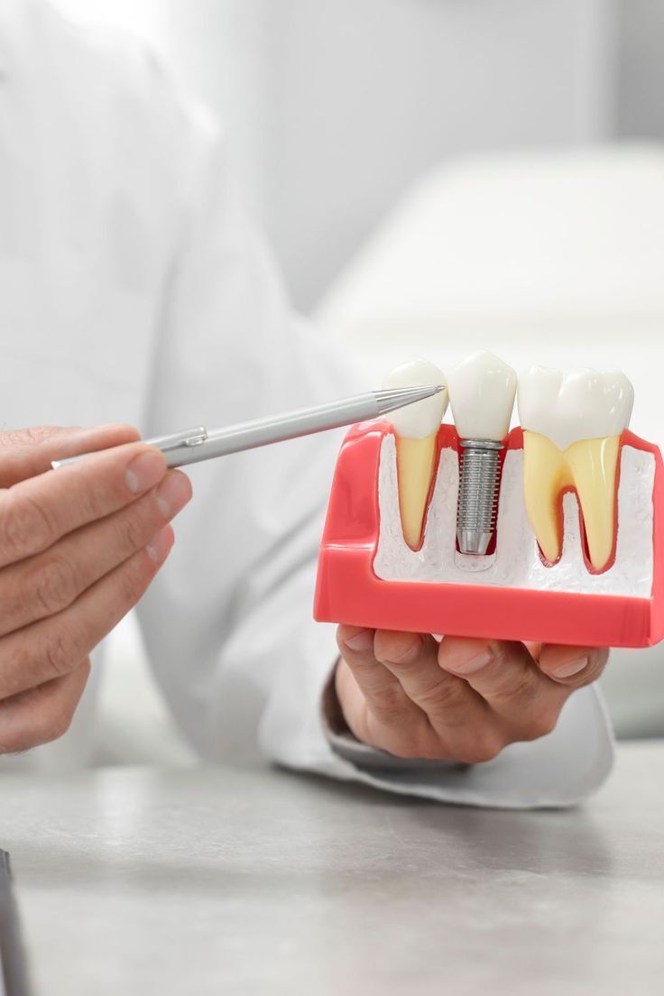 dental implant considered as an important dental prosthodontic procedure