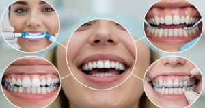 Types of Cosmetic Dental Treatments: Enhance Your Smile