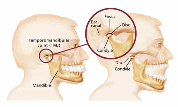 What is TMJ