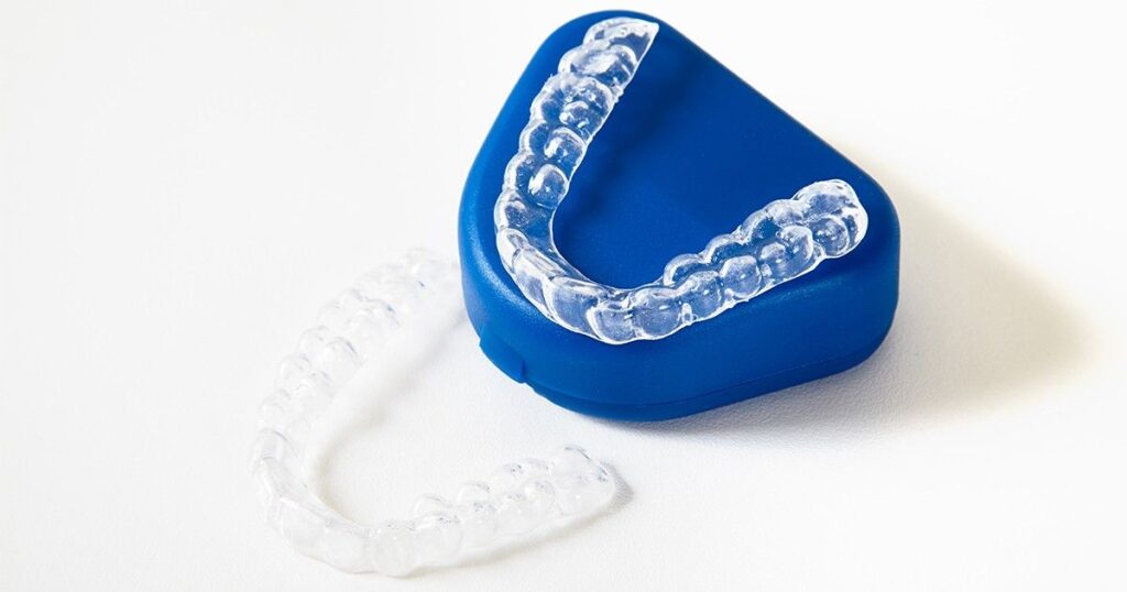Clear aligners on a dental model illustrating Invisalign cost in Newmarket and treatment options.