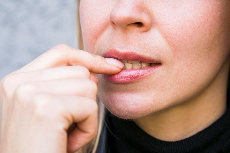 a woman with bite issues who need braces for adults