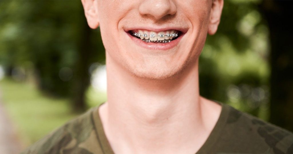 an adult with traditional braces