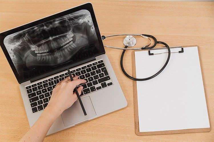 Checking the digital scan for better personalized planning at the Invisalign consultation.
