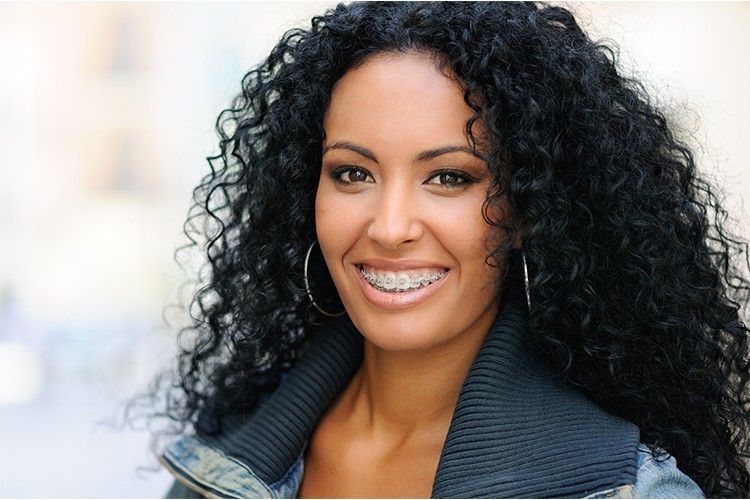 a woman with braces for adults in her 40s