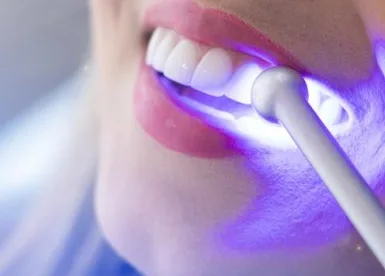 Zoom whitening