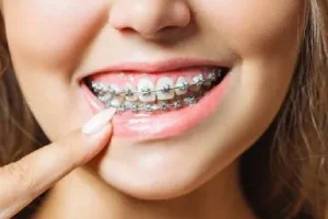 Orthodontist