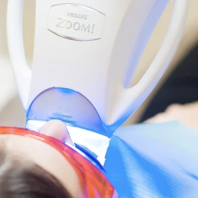 Zoom Whitening