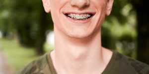 an adult with traditional braces