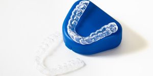 Clear aligners on a dental model illustrating Invisalign cost in Newmarket and treatment options.
