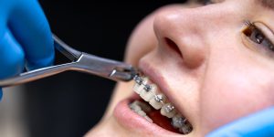 a girl with traditional braces as one of the most common orthodontic treatment options