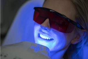 teeth whitening