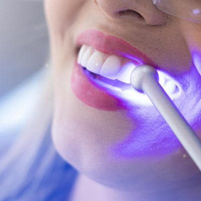 teeth whitening1