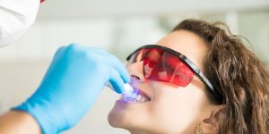 the best teeth whitening methods the best teeth whitening methods